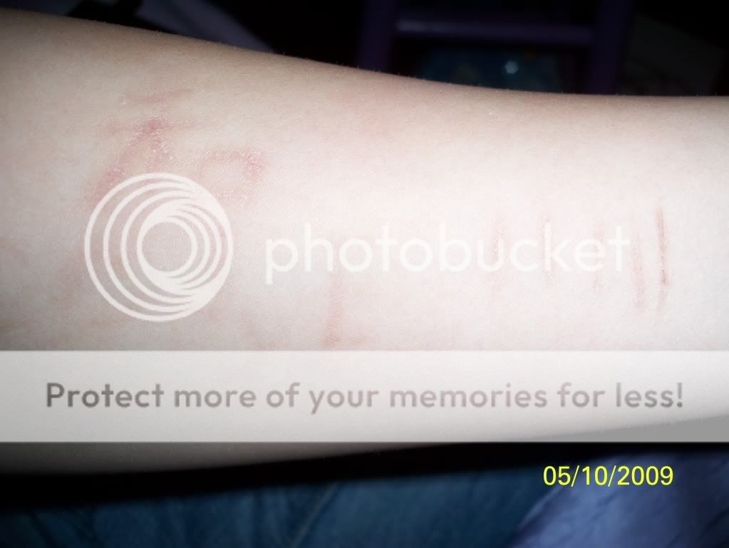 Cuts On Arm Pictures, Images & Photos Photobucket